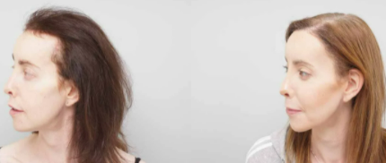 farjo hair institute